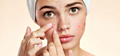 What are the Best Treatments for Acne?
