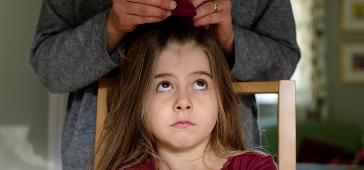 How to Get Ahead of Head Lice