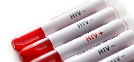 HIV: Promising new approach
